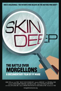 دانلود مستند Skin Deep: The Battle Over Morgellons 2019104233-1815919483